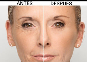 SUERO DE RETINOL-ANTIARRUGAS