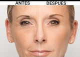 SUERO DE RETINOL-ANTIARRUGAS